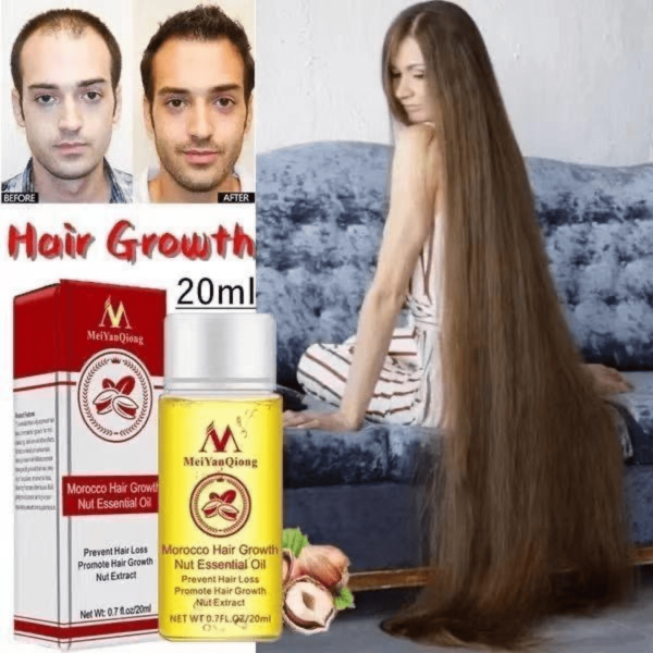 Hair Growth Spray